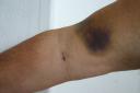 arm.jpg